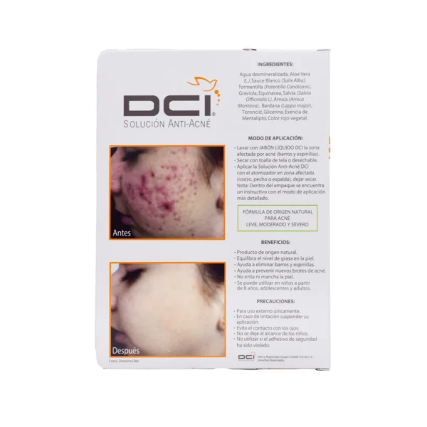 Solucion Antiacne 60 Ml3 Solucion Antiacne 60 Ml